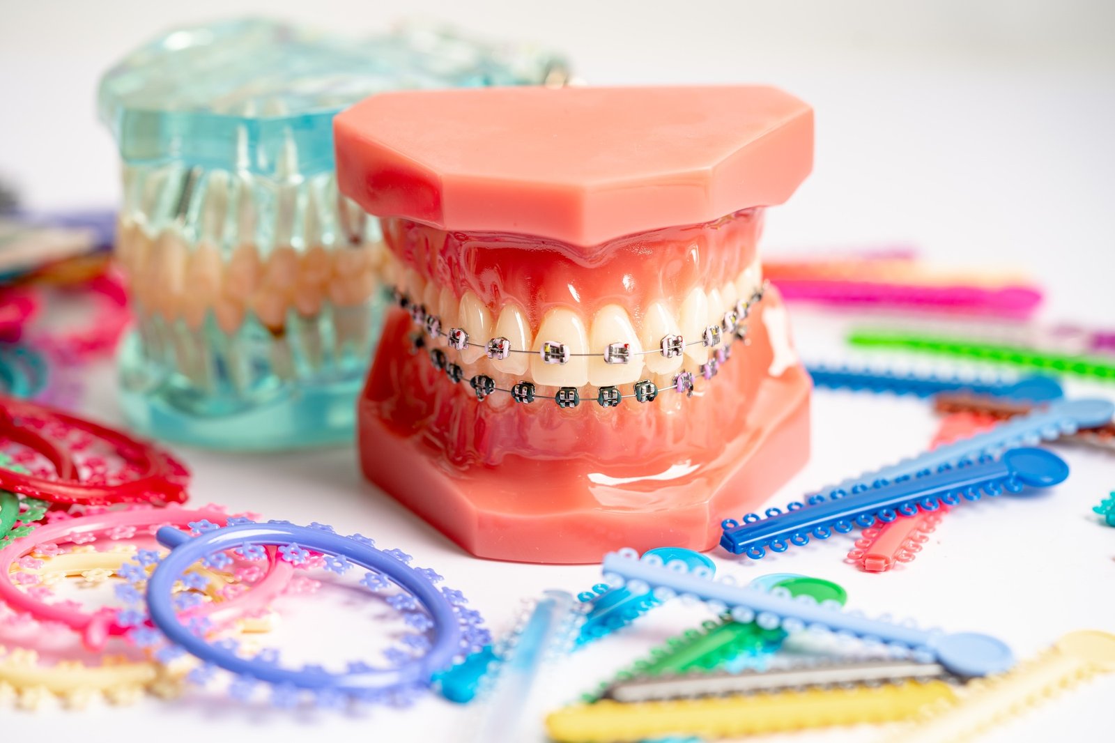 Orthodontic ligatures rings and ties, elastic rubber bands on orthodontic braces,