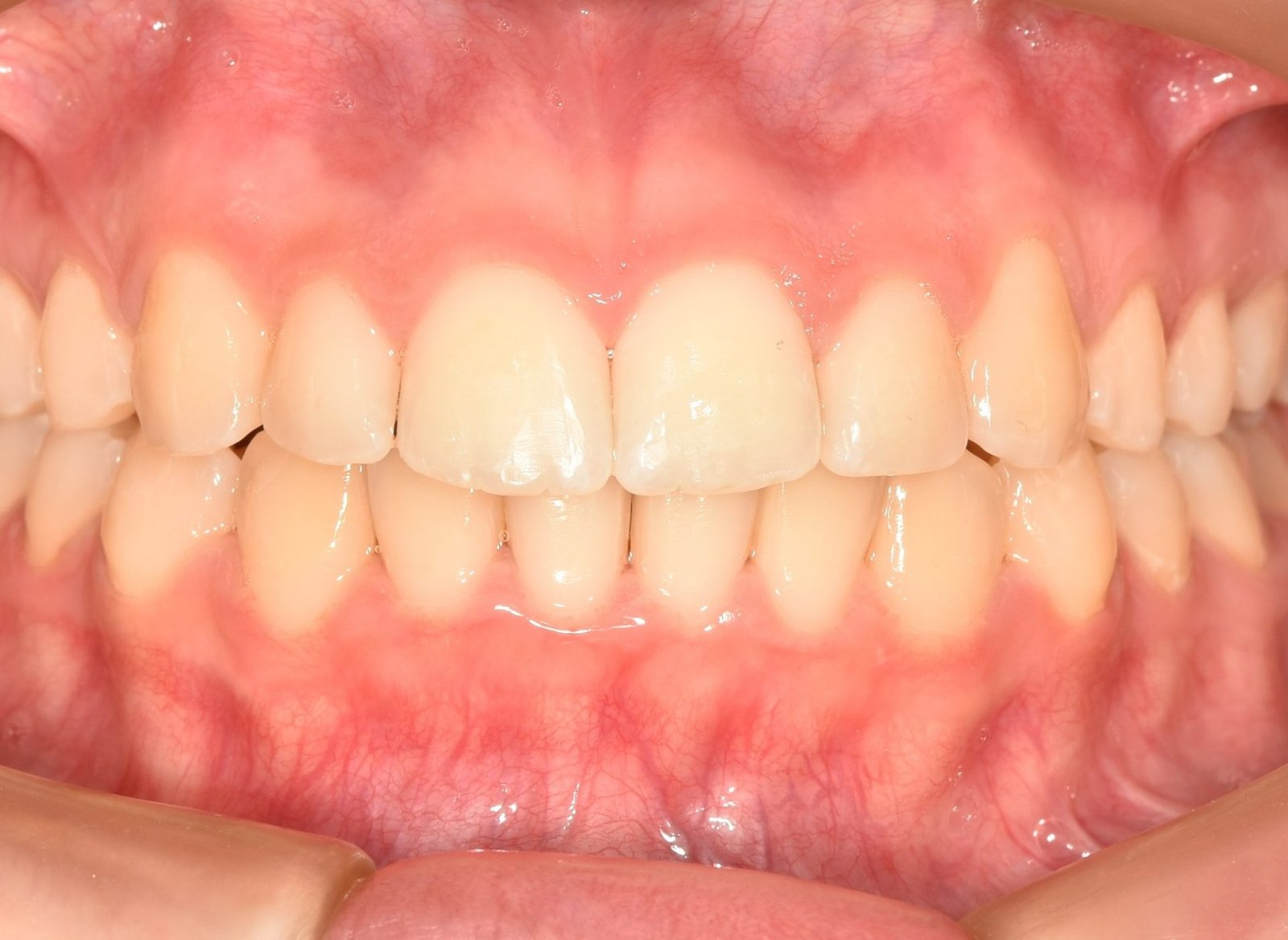 3EB007713E10F992CFB8DE