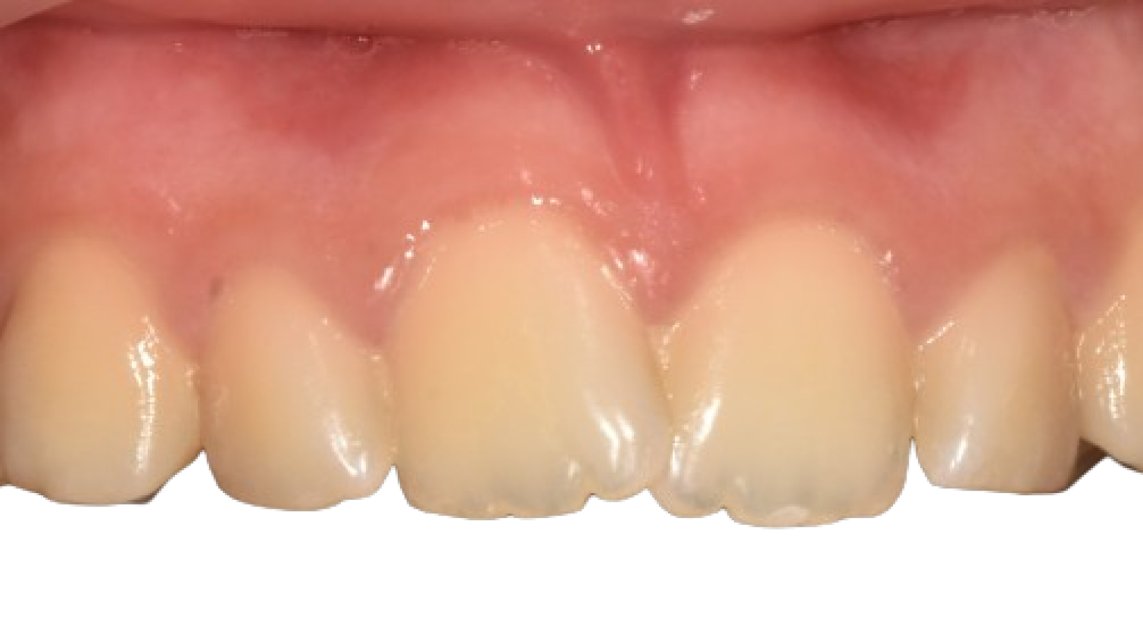 DSC_0006-removebg-preview