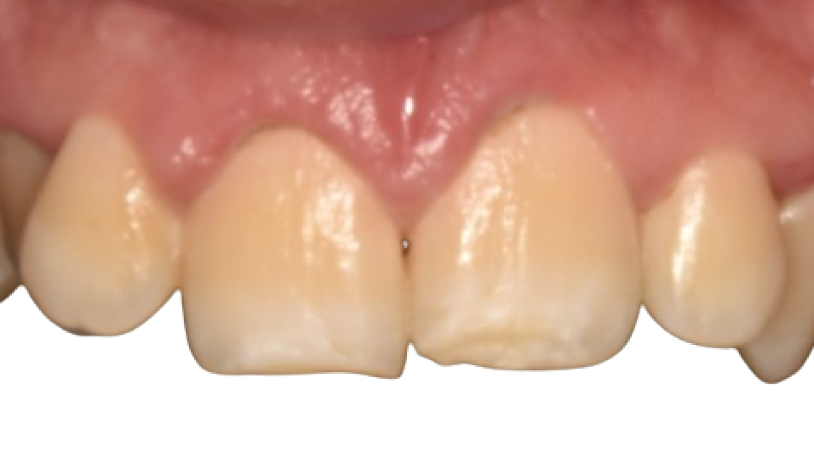 DSC_0012-removebg-preview